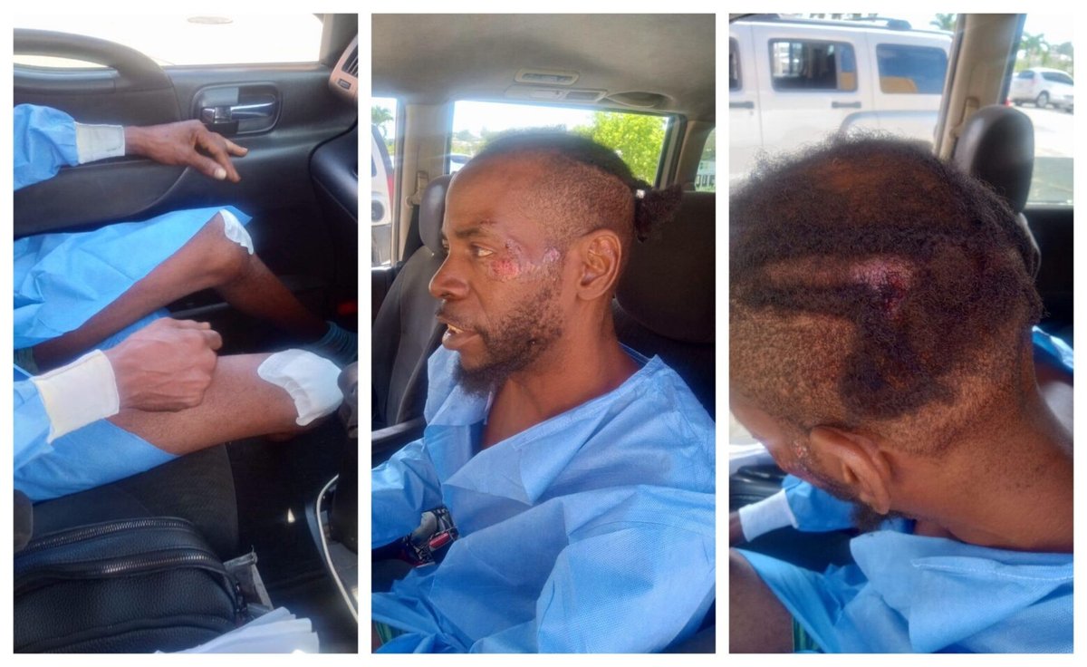 Man Beaten, Robbed and Left Unconscious at West Bus Station