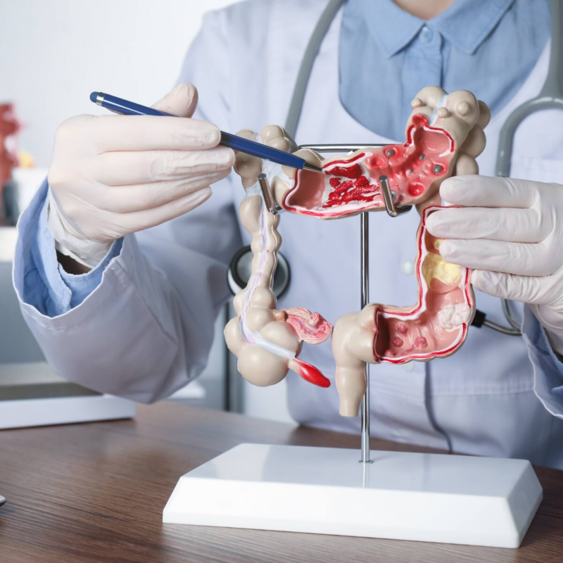 Young Adults Increasingly Diagnosed With Gastrointestinal Cancers, Doctors Warn